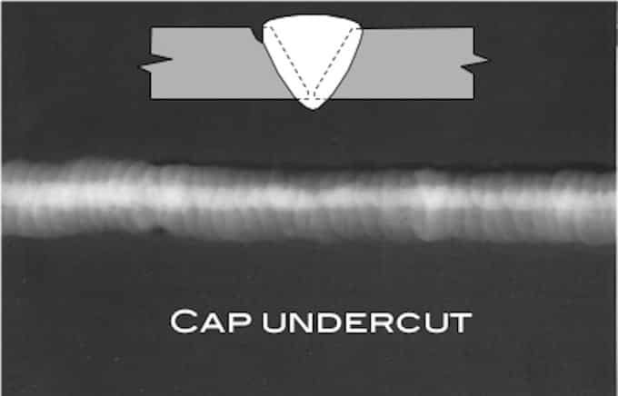 Cap undercut