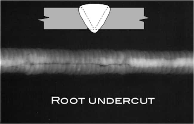 Root undercut